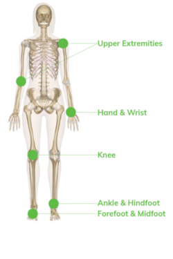 Ossio Skeleton - Uses